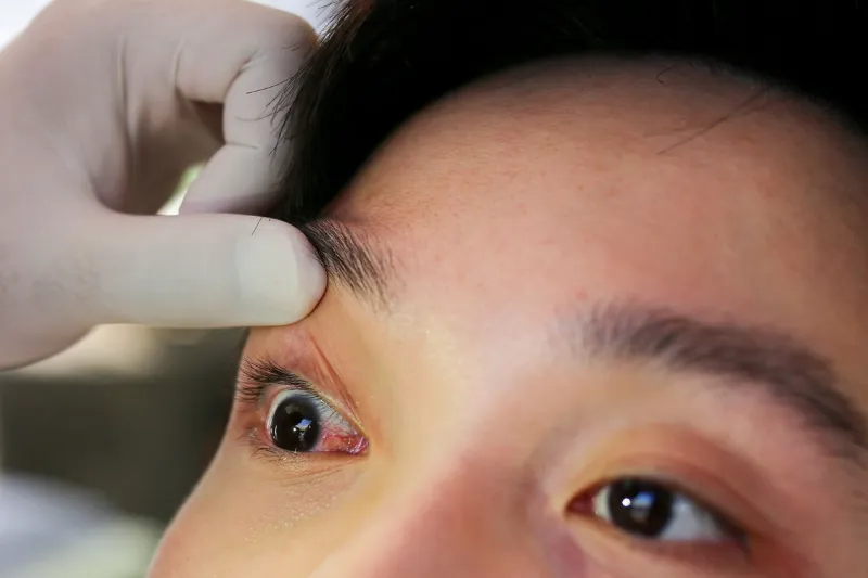 Eye Emergency Services in New Braunfels, TX