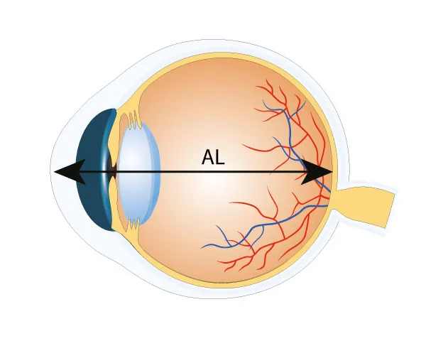 axial length